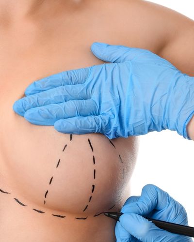 What Do Breast Lift Scars Look Like, and How Do They Heal?